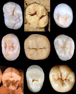 The Teeth of Early Neanderthals May Indicate the Species' Lineage Is Older Than Thought