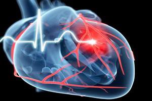عوارض ناشی از بیماری‌های قلبی با سلول‌های بنیادی کاهش می‌یابد