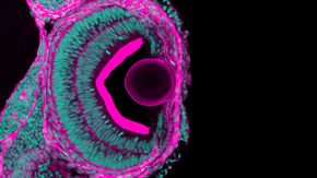 The genes that make squid eyes also make your legs