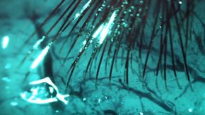 Elon Musk’s startup eyes human testing for brain-computer interface