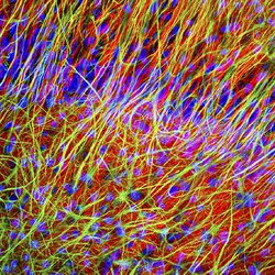 Hallucinations implanted in mouse brains using light