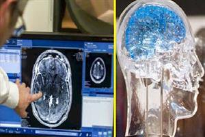 پژوهشگران با دریافت فناوری های پیشرفته مسیرهای شناخت مغز را سرعت دادند
