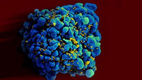 Can an immune strategy used to treat cancer also wipe out HIV infections?