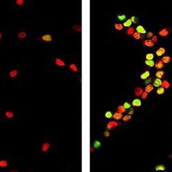 Cambridge scientists reverse ageing process in rat brain stem cells