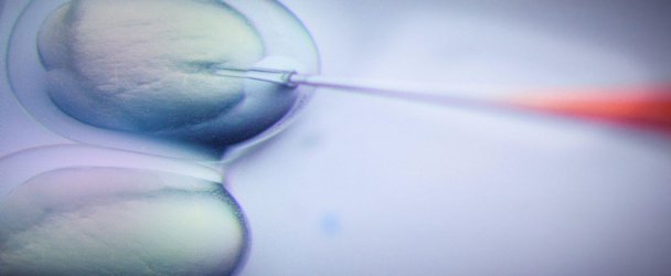 Four U.S. CRISPR Trials Editing Human DNA to Research New Treatments