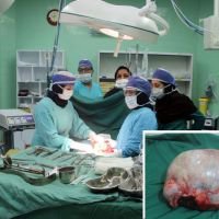 خارج کردن توده ۷ کیلویی از لگن خانم۲۹ ساله  با جراحی ۳ ساعته در بیمارستان فسا