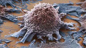 Some cancer drugs miss their target. CRISPR could improve their aim