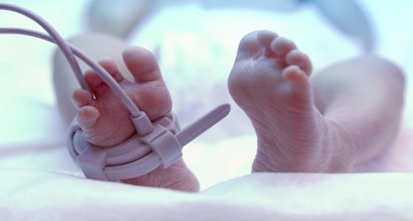 Risk of brain damage in premature babies may reduce if born in specialist units