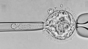 Screening embryos for IQ and other complex traits is premature, study concludes