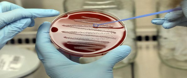 Harmful Bacteria Masquerade as Red Blood Cells to Evade the Immune System