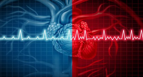 Deeper understanding of irregular heartbeat may lead to more effective treatment
