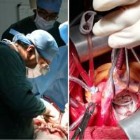 برای اولین بار در فسا؛  انجام موفقیت آمیز عمل جراحی پیچیده ترمیم دریچه میترال قلب در بیمارستان حضرت ولیعصر(عج)