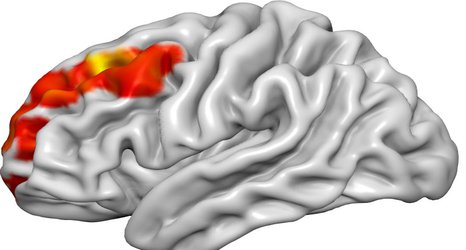 Kisspeptin hormone injection can boost brain activity associated with attraction