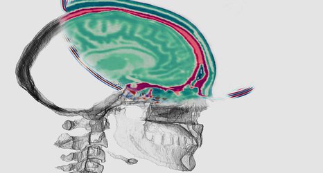 Seismic imaging technology could deliver detailed images of the human brain