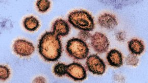 WHO launches global megatrial of the four most promising coronavirus treatments