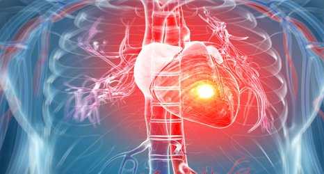 Protein can identify heart patients at increased risk of death