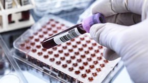 DNA blood test spots cancers in seemingly cancer-free women, but also produces false alarms