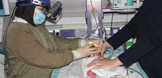 درمان چشم نوزاد نارس با لیزر برای اولین بار در بیمارستان مهدیه