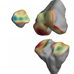 Improved MRI scans could aid in development of arthritis treatments