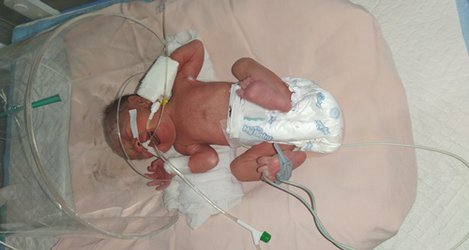 تولد بیستمین نوزاد ivf بیمارستان بی بی حکسمه(س) گچساران