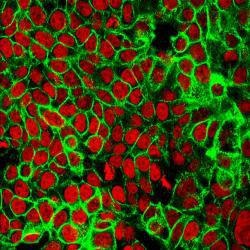 Blood test to monitor cancer up to ten times more sensitive than current methods