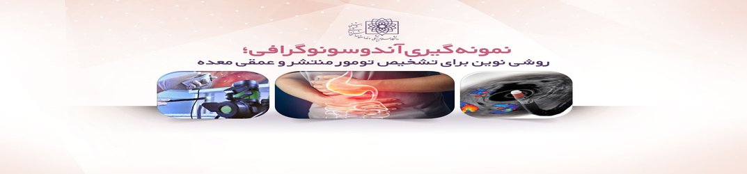 نمونه گیری آندوسونوگرافی؛ روشی نوین برای تشخیص تومور منتشر و عمقی معده/ اصلی ترین علت مرگ با تومور جدار معده تشخیص دیرهنگام است
