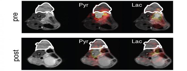 Imaging technique could replace tissue biopsies in assessing drug resistance in breast cancer patients