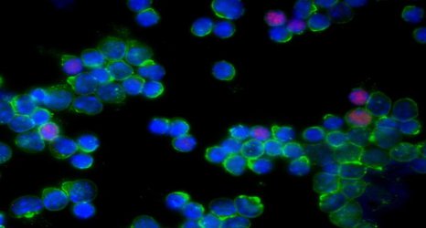 Severe COVID-19 infection linked to overactive immune cells