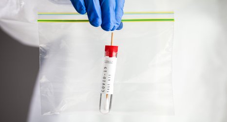 Imperial part of London Alliance offering 20,500 more COVID tests a day by March