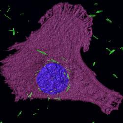 Tiny golden bullets could help tackle asbestos-related cancers