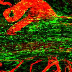 Why it takes guts to protect the brain against infection