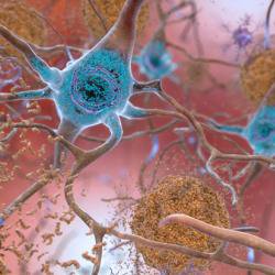 Researchers show how to target a 'shape-shifting' protein in Alzheimer’s disease