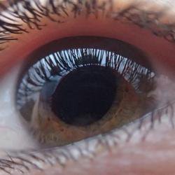 Technique to regenerate the optic nerve offers hope for future glaucoma treatment