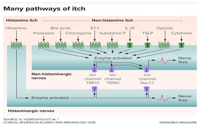 The Search for What Causes Chronic Itching