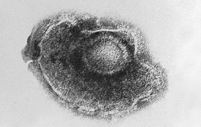 Discovery explains how the chickenpox and shingles virus remains dormant