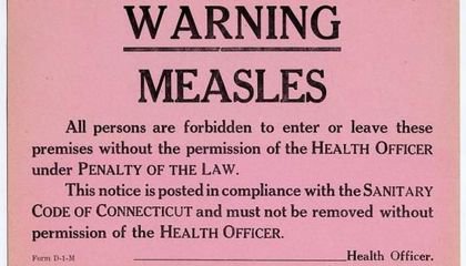 How Failed Quarantines Led to 20th-Century Measles Outbreaks