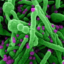 How accurate were early expert predictions on COVID-19, and how did they compare to the public?