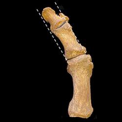 Fashion for pointy shoes unleashed a plague of bunions in medieval Britain