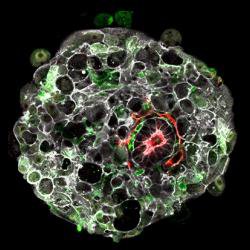 Study identifies trigger for ‘head-to-tail’ axis development in human embryo