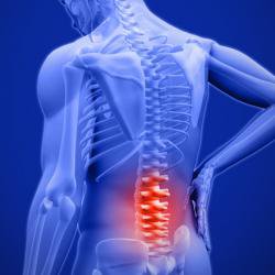 Inflatable, shape-changing spinal implants could help treat severe pain