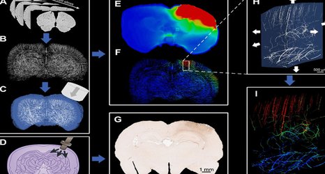 Brain injury computer models map brain blood vessels in highest resolution yet 