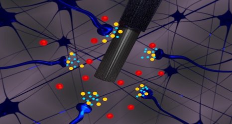 Histamine could be a key player in depression, according to study in mice