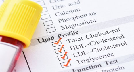 ‘Silent’ high cholesterol condition diagnosed too late and undertreated