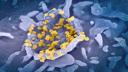 COVID reinfections likely within one or two years, models propose
