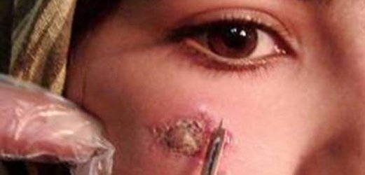 آمادگی دانشگاه علوم پزشکی شهید بهشتی برای مقابله با بیماری سالک