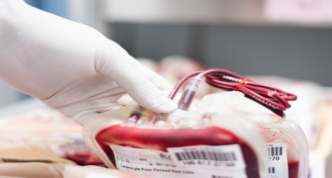 Q&A: How do we make the best use of blood banks in sub-Saharan Africa? 