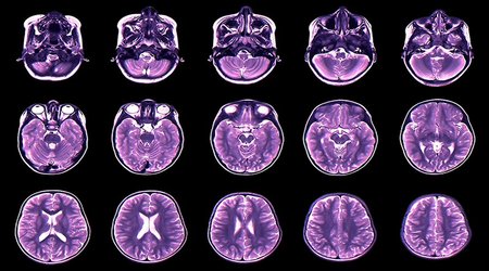 Your brain expands and shrinks over time — these charts show how