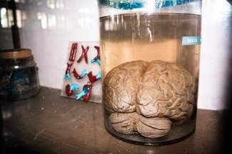 If you grow a brain in a lab, will it have a mind of its own?