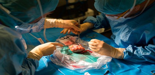 First pig kidneys transplanted into people: what scientists think