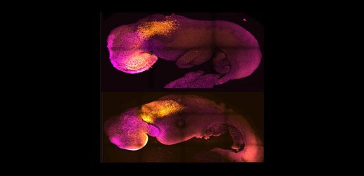 Mouse embryos grown without eggs or sperm: why and what’s next?